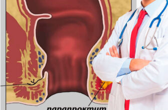 Gemorroy va o‘tirib ishlash: Ish joyini qanday o‘zgartirish kerak?
