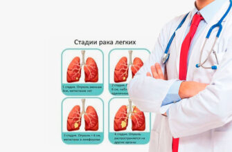 O‘pka saratonini qanday davolash mumkin?