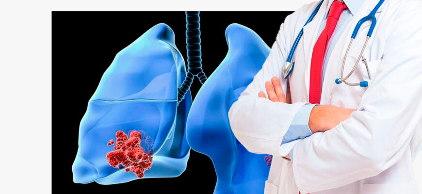 O‘pka saratoni diagnostikasi: Qanday testlar o‘tkaziladi?