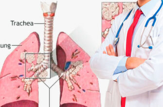 O‘pka saratoni uchun zaruriy vitamin va minerallar