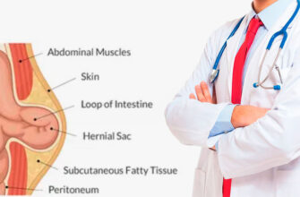 Umurtqa pog‘onasi churrasining ilk belgilari va ularni qanday aniqlash mumkin?