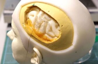 Felçli hastaların düşüncelerini metne dönüştüren implant oluşturuldu