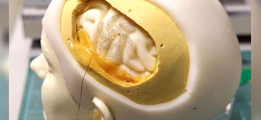 Felçli hastaların düşüncelerini metne dönüştüren implant oluşturuldu